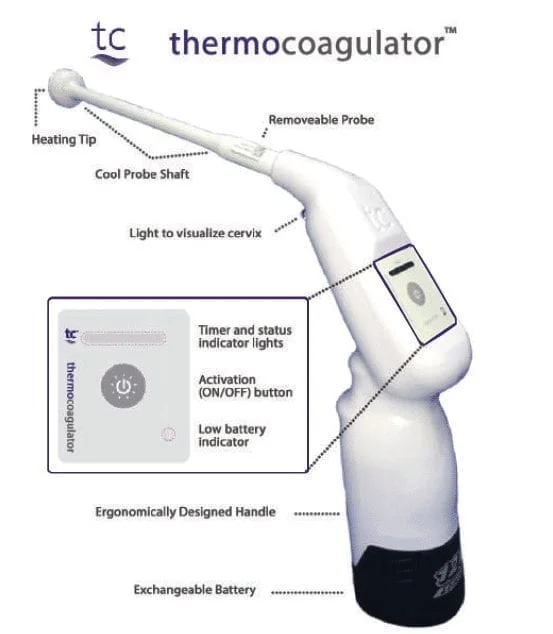 Thermocoagulator Diagram 2