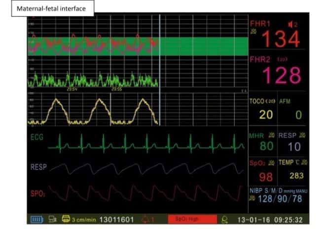 Fetal/Maternal Monitor L8P 4 Fetal/Maternal Monitor L8P - Image 4