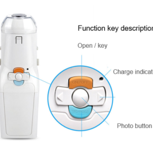 Anjue Portable Mini-Colposcope